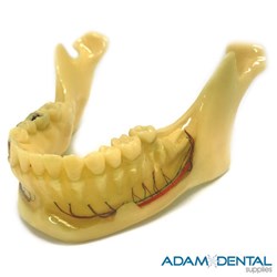 Mandible Natural Size Dental/Education Demonstration Model