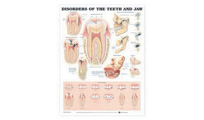 Educational Dental Posters