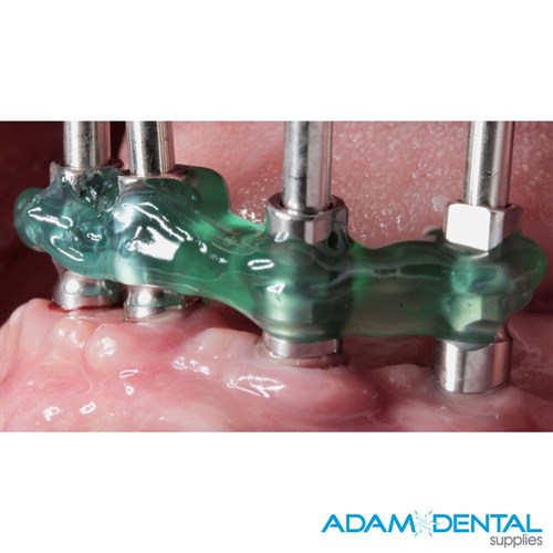 TDV Resinlay Pattern Gel 3g Light Cure 3g + 3 tips