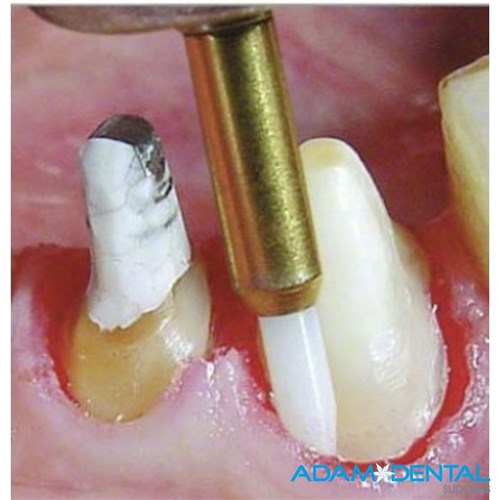 Ceramic Soft Tissue Trimmer