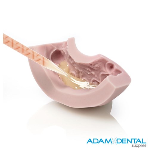 Zhermack Impression Putty