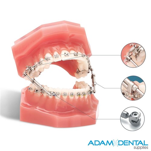 Double Lock Device 27 - 36mm